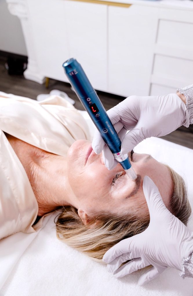 Professional microneedling treatment using the ILUMIPEN device to activate fibroblasts, boost collagen, and refine skin texture.