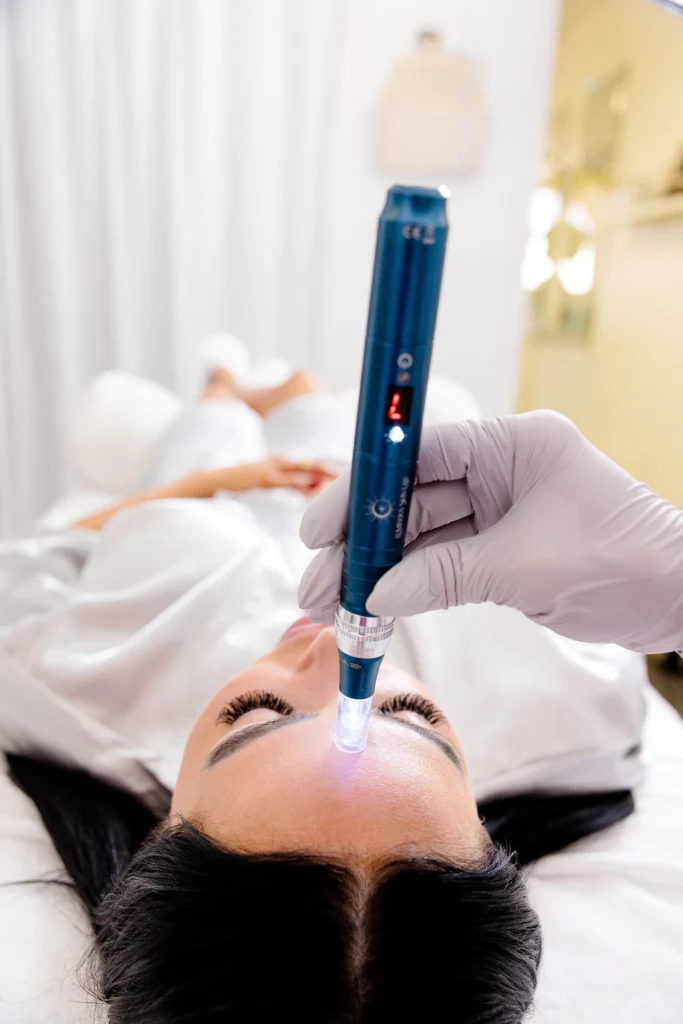 What to expect after microneedling including skin recovery timeline, safety, and visible results